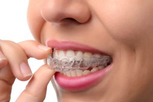 Invisalign for the Holidays Scarborough ME