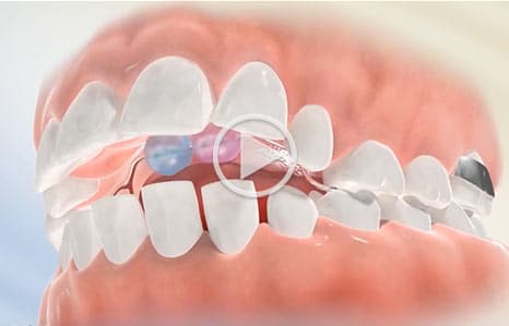 Video at Southern Maine Orthodontics in Scarborough, ME