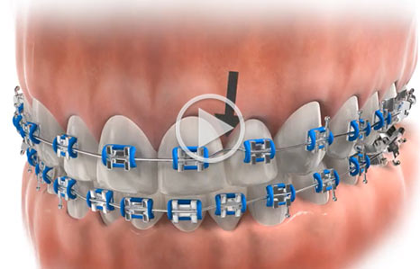 Video at Southern Maine Orthodontics in Scarborough, ME