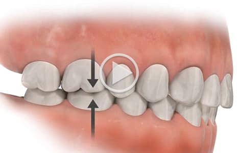 Dissertation dental occlusion