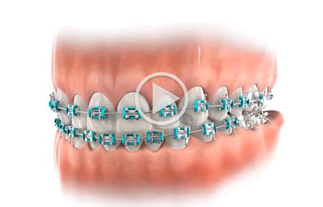Video Southern Maine Orthodontics in Scarborough, ME