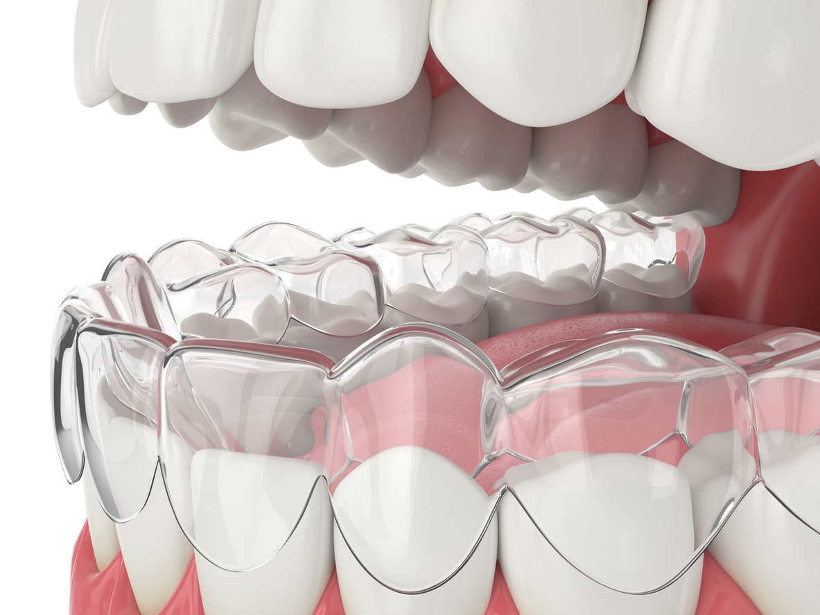 Advanced Technology Scarborough & Gorham ME | Southern Maine Orthodontics
