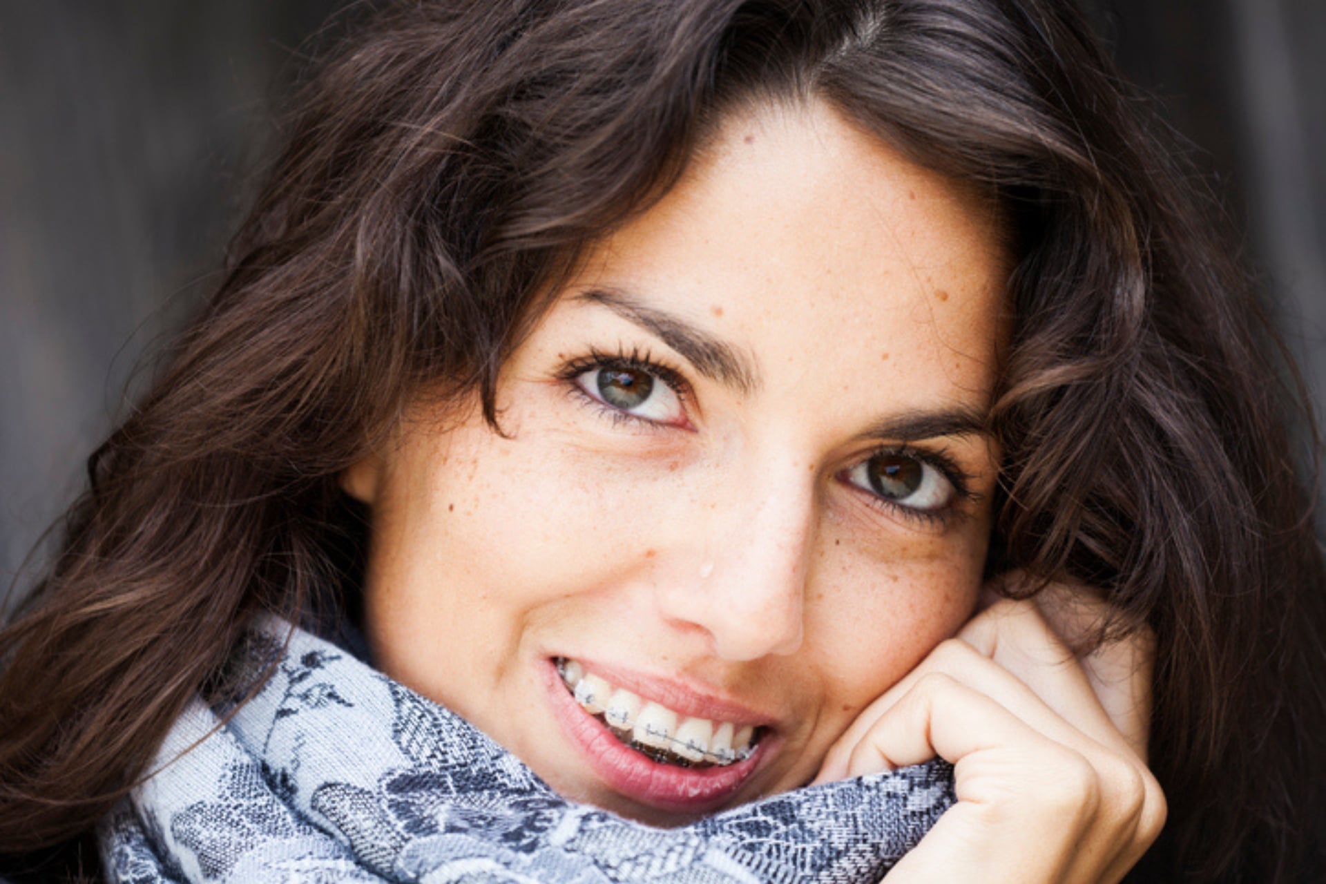 Can Braces Help Improve Gum Health in Gorham, ME? Southern Maine Orthodontics in Scarborough, ME