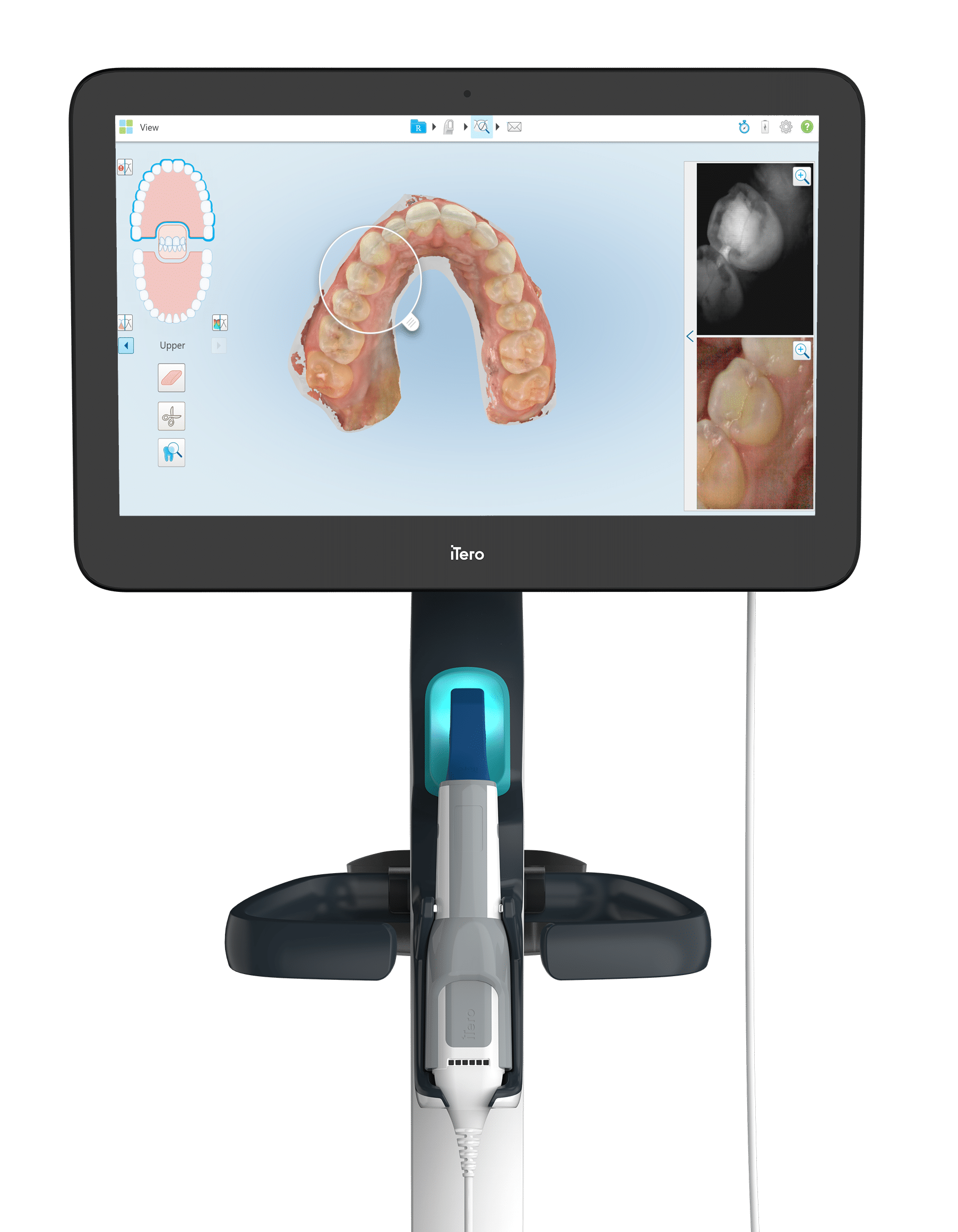 Itero Lumina Scanner - Southern Maine Orthodontics